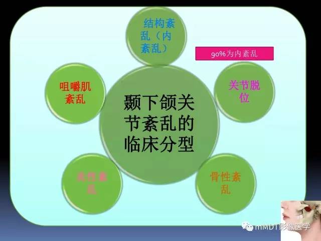 【PPT】颞下颌关节内紊乱的MR诊断
