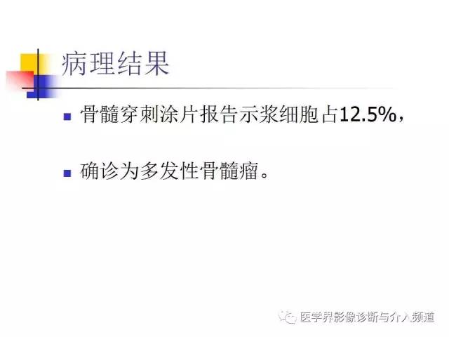【病例】多发性骨髓瘤1例CT影像表现