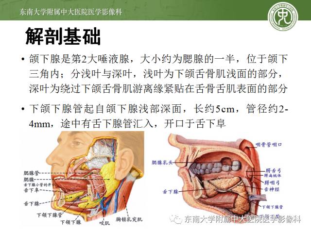 【病例】颌下腺病变6例CT随访 【病例】颌下腺病变6例CT随访