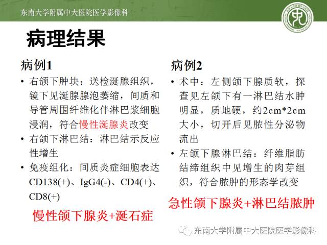 【病例】颌下腺病变6例CT随访 【病例】颌下腺病变6例CT随访