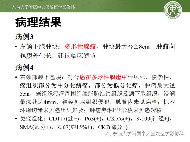 【病例】颌下腺病变6例CT随访 【病例】颌下腺病变6例CT随访