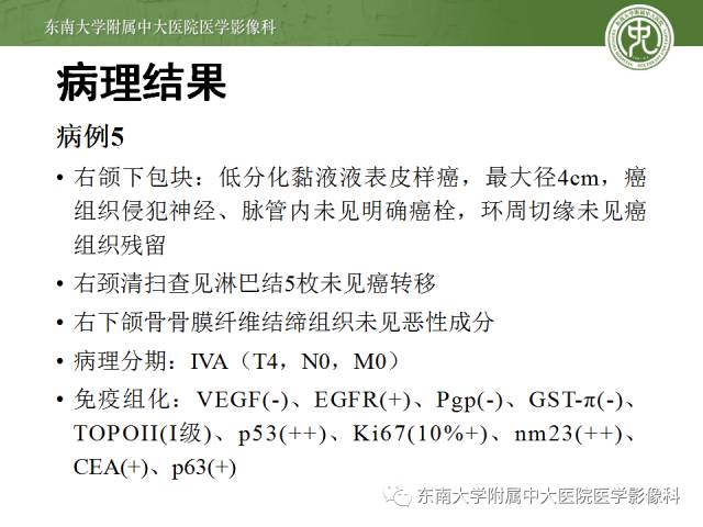 【病例】颌下腺病变6例CT随访 【病例】颌下腺病变6例CT随访