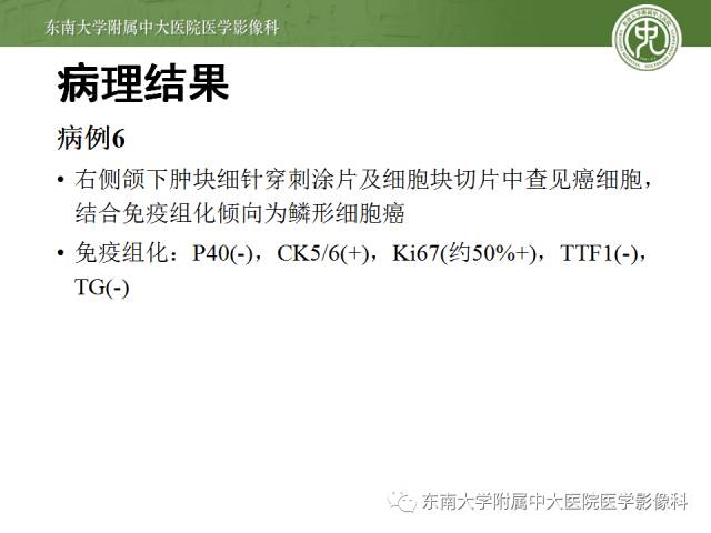 【病例】颌下腺病变6例CT随访 【病例】颌下腺病变6例CT随访