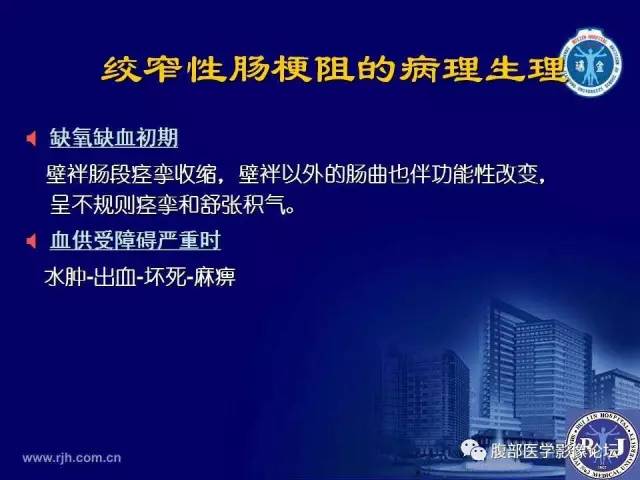 【PPT】绞窄性肠梗阻CT诊断