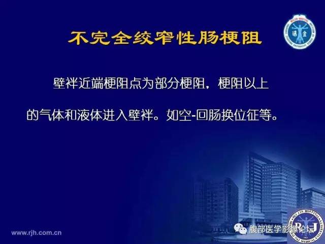 【PPT】绞窄性肠梗阻CT诊断