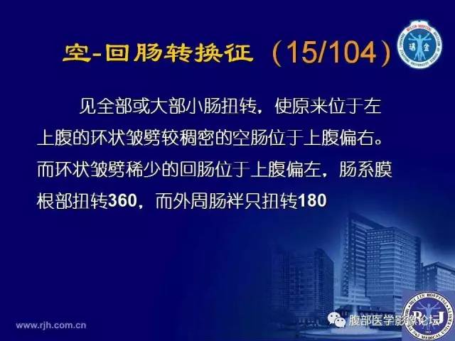 【PPT】绞窄性肠梗阻CT诊断