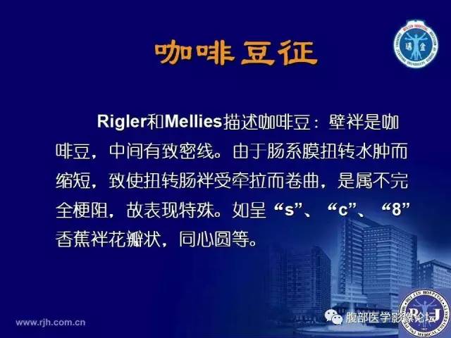 【PPT】绞窄性肠梗阻CT诊断