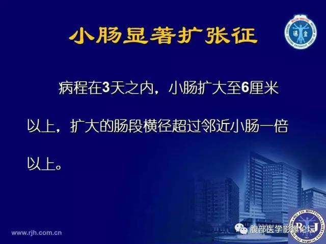 【PPT】绞窄性肠梗阻CT诊断