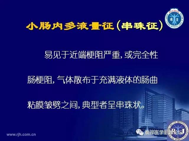 【PPT】绞窄性肠梗阻CT诊断