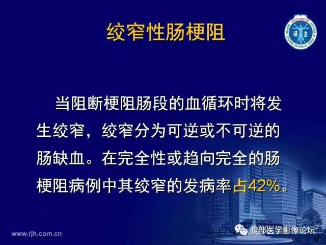 【PPT】绞窄性肠梗阻CT诊断