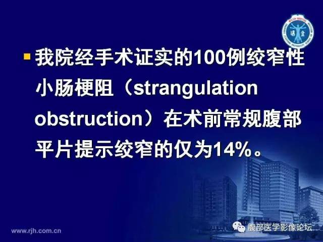 【PPT】绞窄性肠梗阻CT诊断