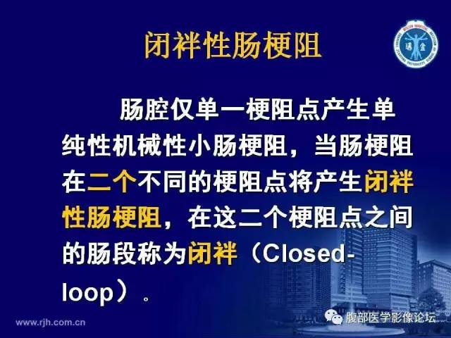 【PPT】绞窄性肠梗阻CT诊断