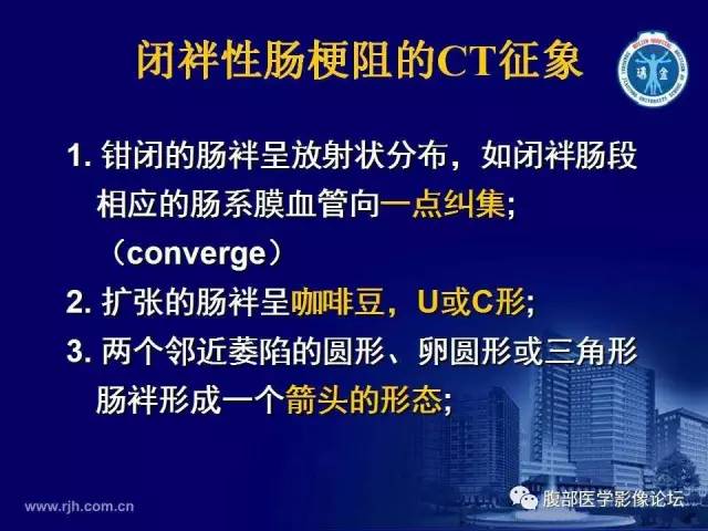 【PPT】绞窄性肠梗阻CT诊断