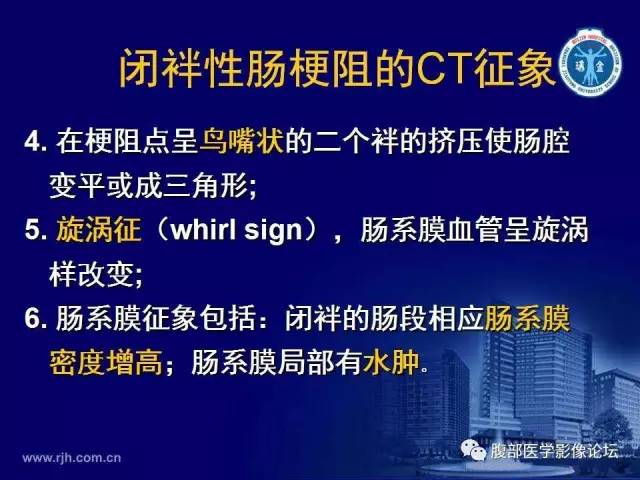 【PPT】绞窄性肠梗阻CT诊断