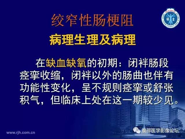 【PPT】绞窄性肠梗阻CT诊断