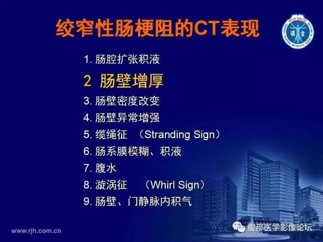【PPT】绞窄性肠梗阻CT诊断
