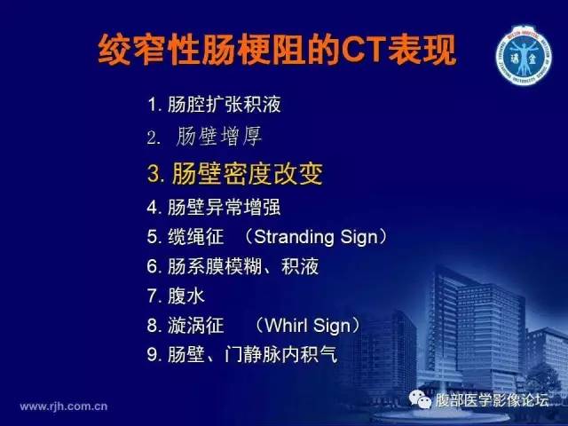 【PPT】绞窄性肠梗阻CT诊断