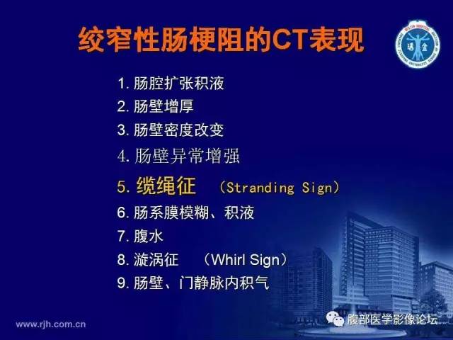 【PPT】绞窄性肠梗阻CT诊断