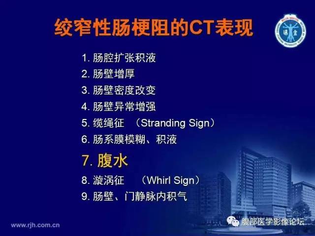 【PPT】绞窄性肠梗阻CT诊断