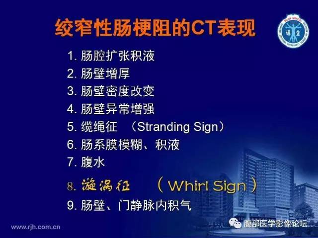 【PPT】绞窄性肠梗阻CT诊断