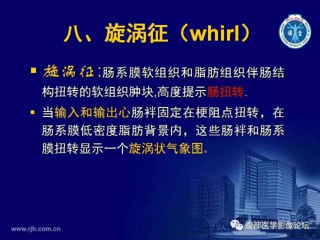 【PPT】绞窄性肠梗阻CT诊断