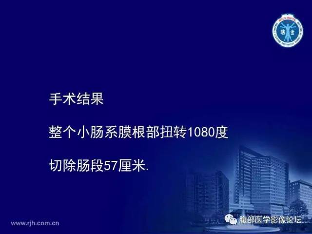 【PPT】绞窄性肠梗阻CT诊断