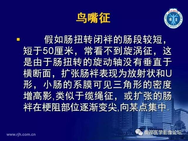 【PPT】绞窄性肠梗阻CT诊断