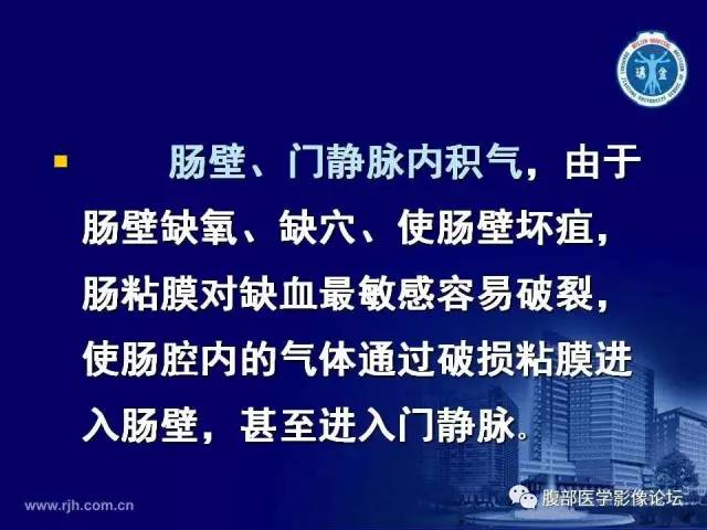 【PPT】绞窄性肠梗阻CT诊断