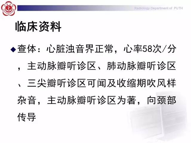 【病例】主动脉缩窄1例CT影像表现