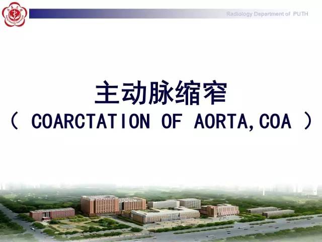 【病例】主动脉缩窄1例CT影像表现
