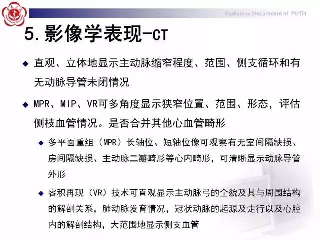 【病例】主动脉缩窄1例CT影像表现