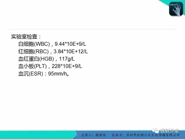【病例】纤维型脑膜瘤1例CT及MR影像表现