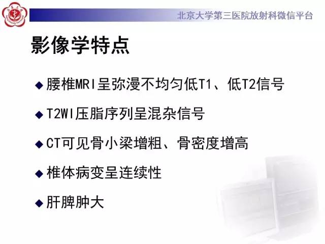 【病例】(脊柱)骨髓纤维化1例CT及MR影像表现
