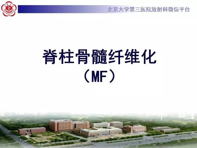 【病例】(脊柱)骨髓纤维化1例CT及MR影像表现