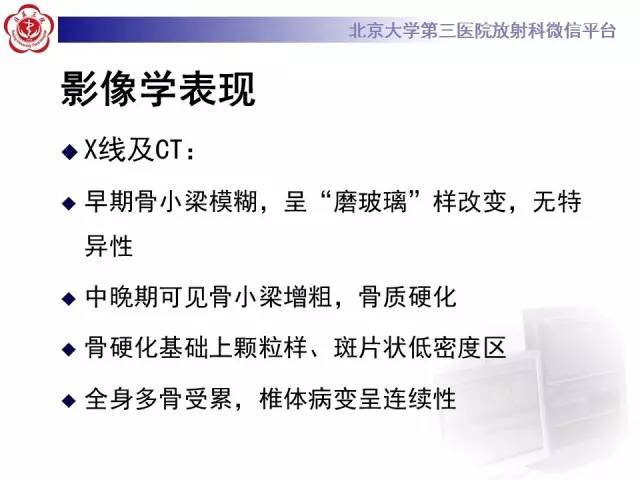 【病例】(脊柱)骨髓纤维化1例CT及MR影像表现