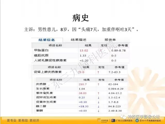 【病例】松果体成熟型囊性畸胎瘤1例CT及MR