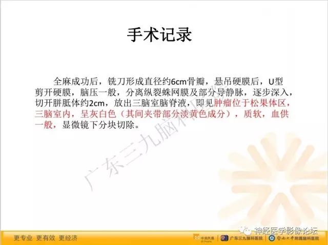 【病例】松果体成熟型囊性畸胎瘤1例CT及MR