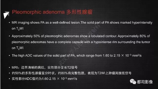 【PPT】腮腺囊性病变影像诊断
