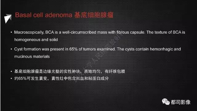 【PPT】腮腺囊性病变影像诊断