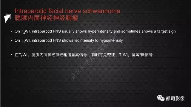 【PPT】腮腺囊性病变影像诊断