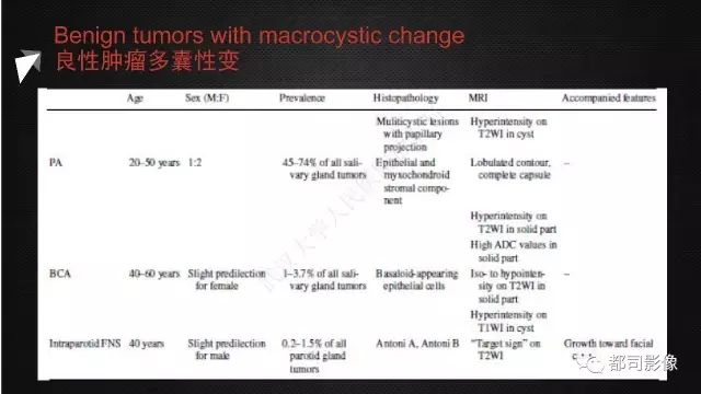 【PPT】腮腺囊性病变影像诊断