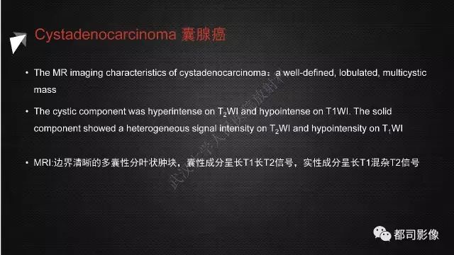 【PPT】腮腺囊性病变影像诊断