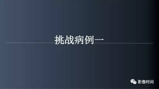 【病例】脑内环形强化3例影像诊断与分析