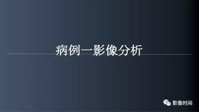 【病例】脑内环形强化3例影像诊断与分析