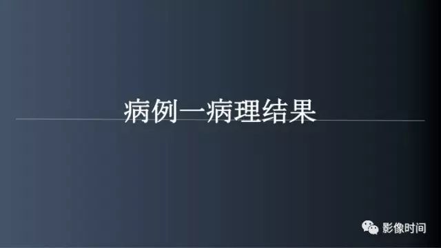 【病例】脑内环形强化3例影像诊断与分析