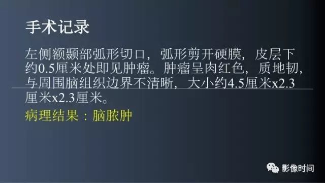 【病例】脑内环形强化3例影像诊断与分析