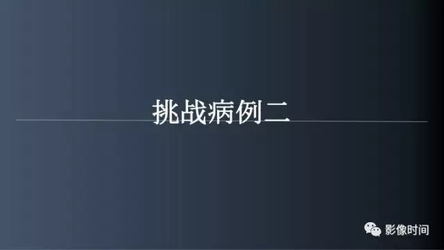【病例】脑内环形强化3例影像诊断与分析