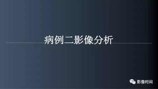 【病例】脑内环形强化3例影像诊断与分析