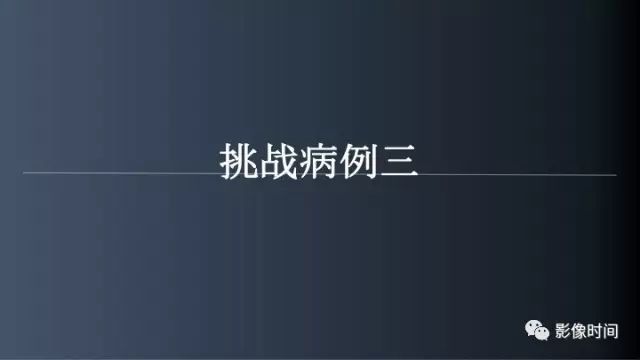 【病例】脑内环形强化3例影像诊断与分析