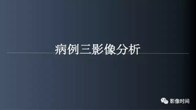 【病例】脑内环形强化3例影像诊断与分析